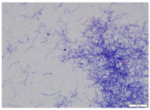 Figure 3. Modified Kinyoun stain demonstrating non-acid fast staining bacilli. Magnification 1000×.